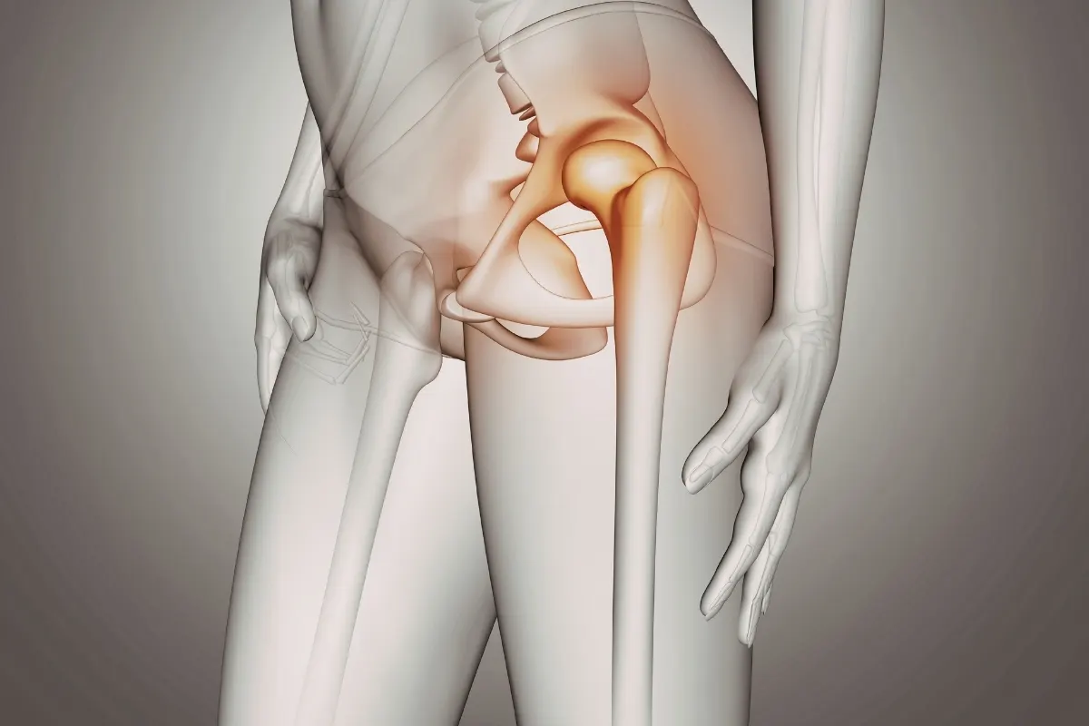 Osteitis Pubis Tedavisi